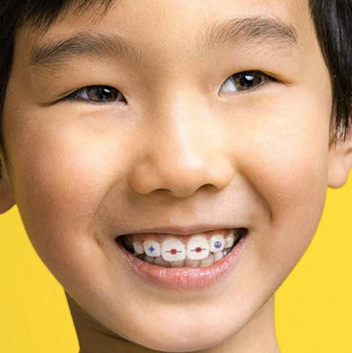 Invisalign™ Starter-Kit – Invisalign Accessory Store Europe